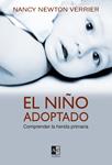 NIÑO ADOPTADO, EL | 9788493441647 | NEWTON, NANCY | Llibreria Drac - Llibreria d'Olot | Comprar llibres en català i castellà online